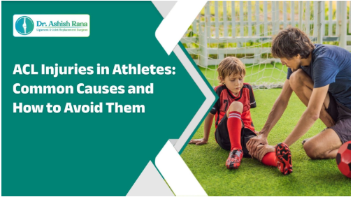 ACL Injuries in Athletes: Common Causes and How to Avoid Them