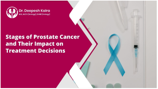 Stages of Prostate Cancer and Their Impact on Treatment Decisions  